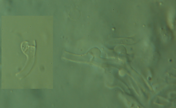Sono sicuro che siete tutti d''accordo (Skeletocutis amorpha)